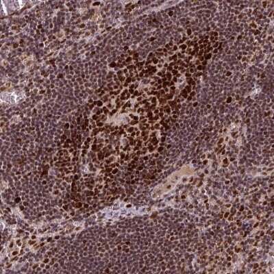 Immunohistochemistry-Paraffin: DNA Polymerase delta, catalytic subunit Antibody [NBP2-33466]