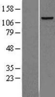 Western Blot: DNA Polymerase delta, catalytic subunit Overexpression Lysate [NBL1-14567]