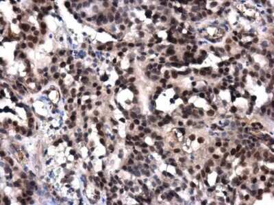 Immunohistochemistry-Paraffin: DNA Polymerase epsilon catalytic subunit A Antibody [NBP3-13067]