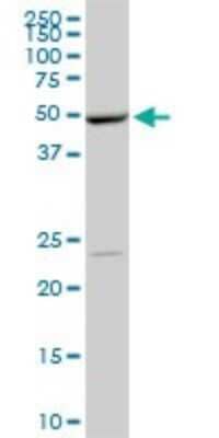 Western Blot: DNA Polymerase epsilon p59 Antibody (1A3) [H00005427-M01]