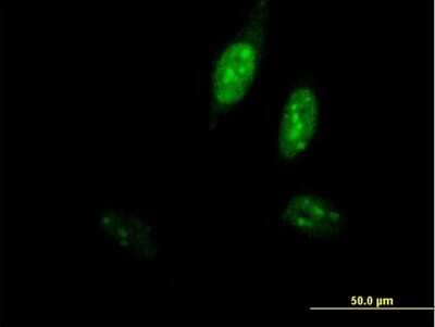 Immunocytochemistry/ Immunofluorescence: DNA Polymerase epsilon subunit 3 Antibody [H00054107-B02P]