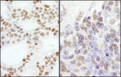 Immunohistochemistry-Paraffin: DNA Polymerase epsilon subunit 3 Antibody [NB100-60438]
