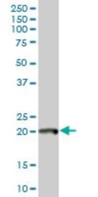 Western Blot: DNA Polymerase epsilon subunit 3 Antibody [H00054107-B02P]