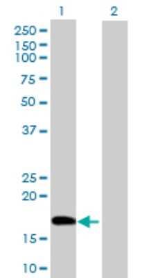 Western Blot: DNA Polymerase epsilon subunit 3 Antibody [H00054107-B02P]