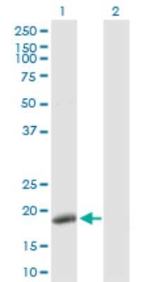 Western Blot: DNA Polymerase epsilon subunit 3 Antibody [H00054107-D01P]