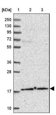 Western Blot: DNA Polymerase epsilon subunit 3 Antibody [NBP2-13785]