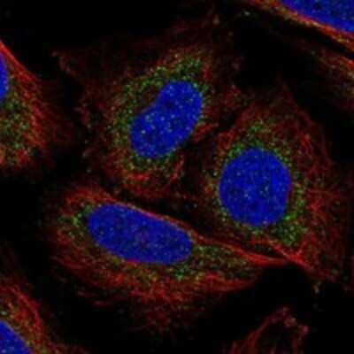 Immunocytochemistry/ Immunofluorescence: DNA Polymerase gamma Antibody [NBP3-17832]