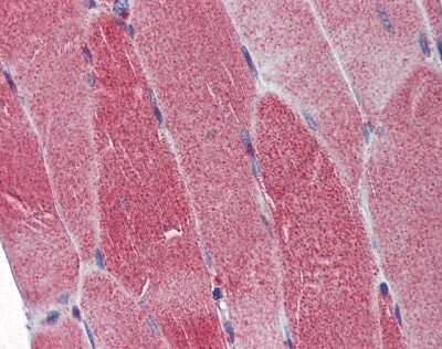 Immunohistochemistry-Paraffin: DNA Polymerase gamma Antibody [NBP1-33633]