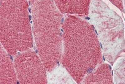 Immunohistochemistry-Paraffin: DNA Polymerase gamma Antibody [NBP1-52300]