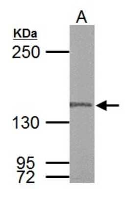 Western Blot: DNA Polymerase gamma Antibody [NBP1-33633]