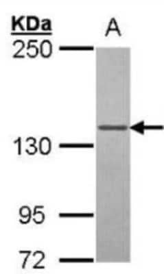 Western Blot: DNA Polymerase gamma Antibody [NBP1-52300]