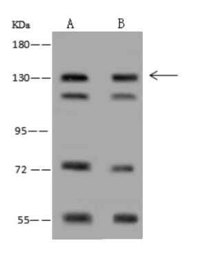 Western Blot: DNA Polymerase gamma Antibody [NBP3-06345]