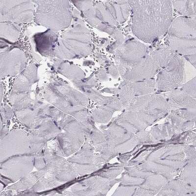 Immunohistochemistry-Paraffin: DNA Polymerase iota Antibody [NBP2-55989]