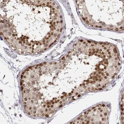 Immunohistochemistry-Paraffin: DNA Polymerase iota Antibody [NBP2-55989]