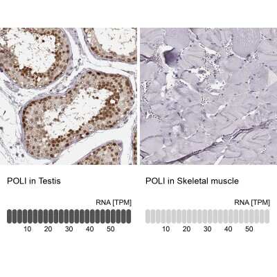 Immunohistochemistry-Paraffin: DNA Polymerase iota Antibody [NBP2-55989]