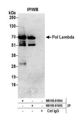 Immunoprecipitation: DNA Polymerase lambda Antibody [NB100-81664]