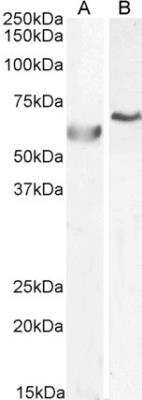 Western Blot: DNA Polymerase lambda Antibody [NB100-1358]