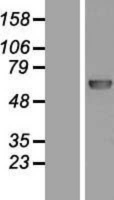 Western Blot: DNA Polymerase lambda Overexpression Lysate [NBL1-14573]