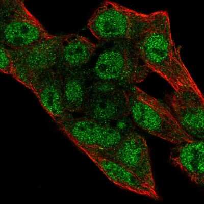 Immunocytochemistry/ Immunofluorescence: DNA Primase large subunit Antibody [NBP2-58498]