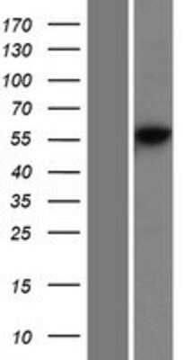 Western Blot: DNA Primase large subunit Overexpression Lysate [NBP2-10719]