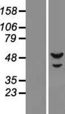 Western Blot: DNA Primase small subunit Overexpression Lysate [NBL1-14755]