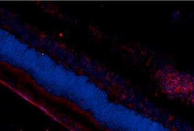 DNA/RNA Damage Products