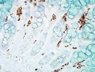 Immunohistochemistry: DNA/RNA Damage Antibody (15A3) [NB110-96878]