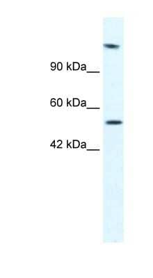 Western Blot: DNA helicase B Antibody [NBP1-57267]