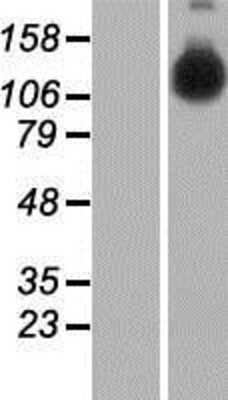 Western Blot: DNA helicase B Overexpression Lysate [NBP2-05870]