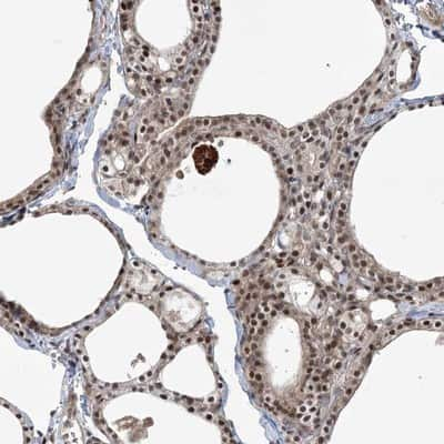 Immunohistochemistry-Paraffin: DNA helicase HEL308 Antibody [NBP1-91842]