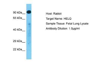 Western Blot: DNA helicase HEL308 Antibody [NBP2-84796]