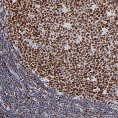 Immunohistochemistry-Paraffin: DNA polymerase alpha Antibody [NBP1-82449]