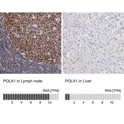 Immunohistochemistry-Paraffin: DNA polymerase alpha Antibody [NBP1-82449]