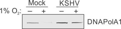 Western Blot: DNA polymerase alpha Antibody [NBP1-47257]