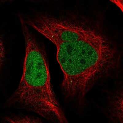 Immunocytochemistry/ Immunofluorescence: DNA polymerase delta p50 Antibody [NBP1-90925]