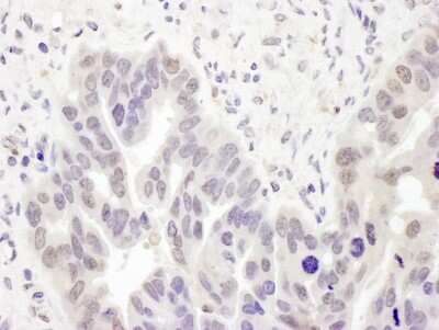 Immunohistochemistry: DNA polymerase delta p50 Antibody [NBP2-32093]