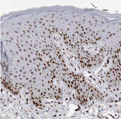 Immunohistochemistry-Paraffin: DNA polymerase delta p50 Antibody [NBP1-90925]