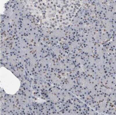 Immunohistochemistry-Paraffin: DNA polymerase delta p50 Antibody [NBP1-90925]