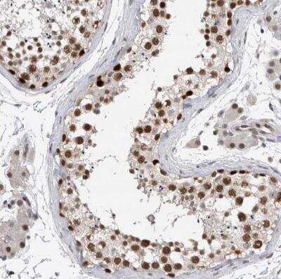 Immunohistochemistry-Paraffin: DNA polymerase delta p50 Antibody [NBP1-90925]