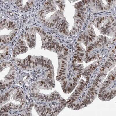 Immunohistochemistry-Paraffin: DNA polymerase delta p50 Antibody [NBP1-90925]