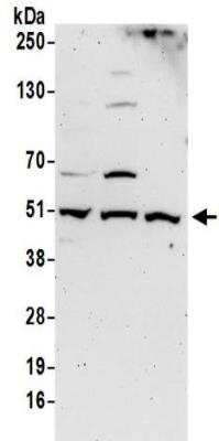 Western Blot: DNA polymerase delta p50 Antibody [NBP2-32093]