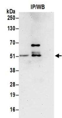 Western Blot: DNA polymerase delta p50 Antibody [NBP2-32093]