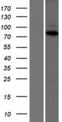 Western Blot: XPV/DNA polymerase eta Overexpression Lysate [NBP2-10408]