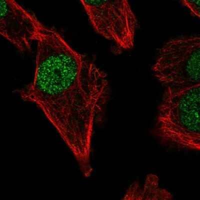 Immunocytochemistry/ Immunofluorescence: DNA polymerase mu Antibody [NBP2-58506]