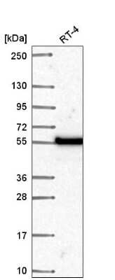 Western Blot: DNA polymerase mu Antibody [NBP2-57664]