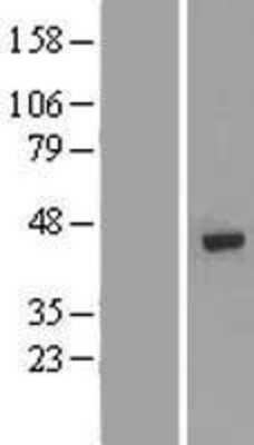 Western Blot: DNA polymerase mu Overexpression Lysate [NBP2-10345]