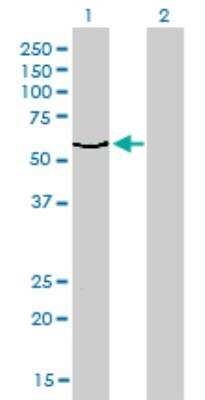 Western Blot: DNA polymerase sigma Antibody (2F8) [H00011044-M01]