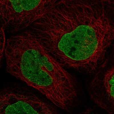 Immunocytochemistry/ Immunofluorescence: DNA polymerase sigma Antibody [NBP2-13728]