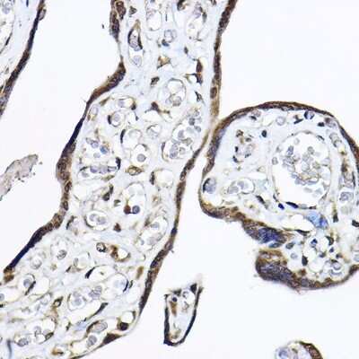 Immunohistochemistry-Paraffin: DNA polymerase sigma Antibody - BSA Free [NBP2-91990]