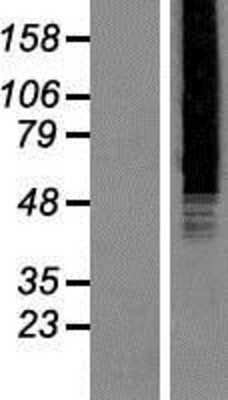 Western Blot: DNA polymerase sigma Overexpression Lysate [NBP2-10388]